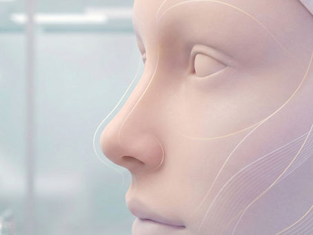 Rinoplastia: resultados naturales sin parecer operada