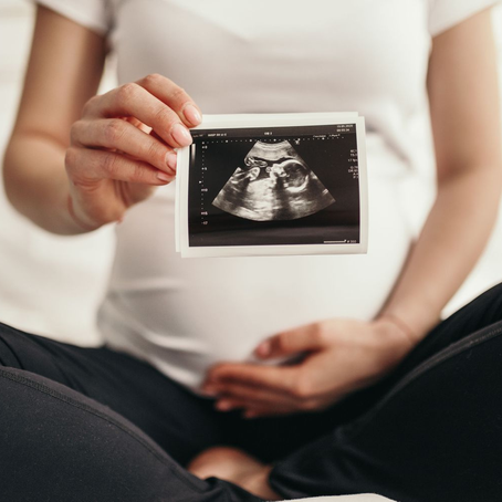 I Had A Fucking Baby. 