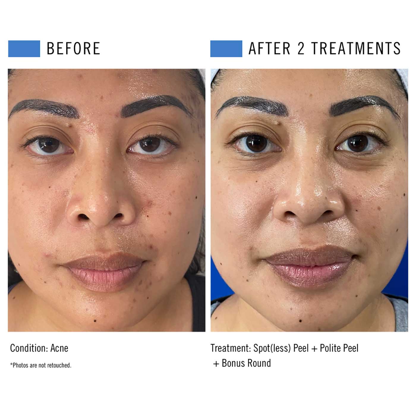 Spotless + Polite Peel - 4.jpg