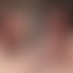 How Amputees can have more fun at Resorts: