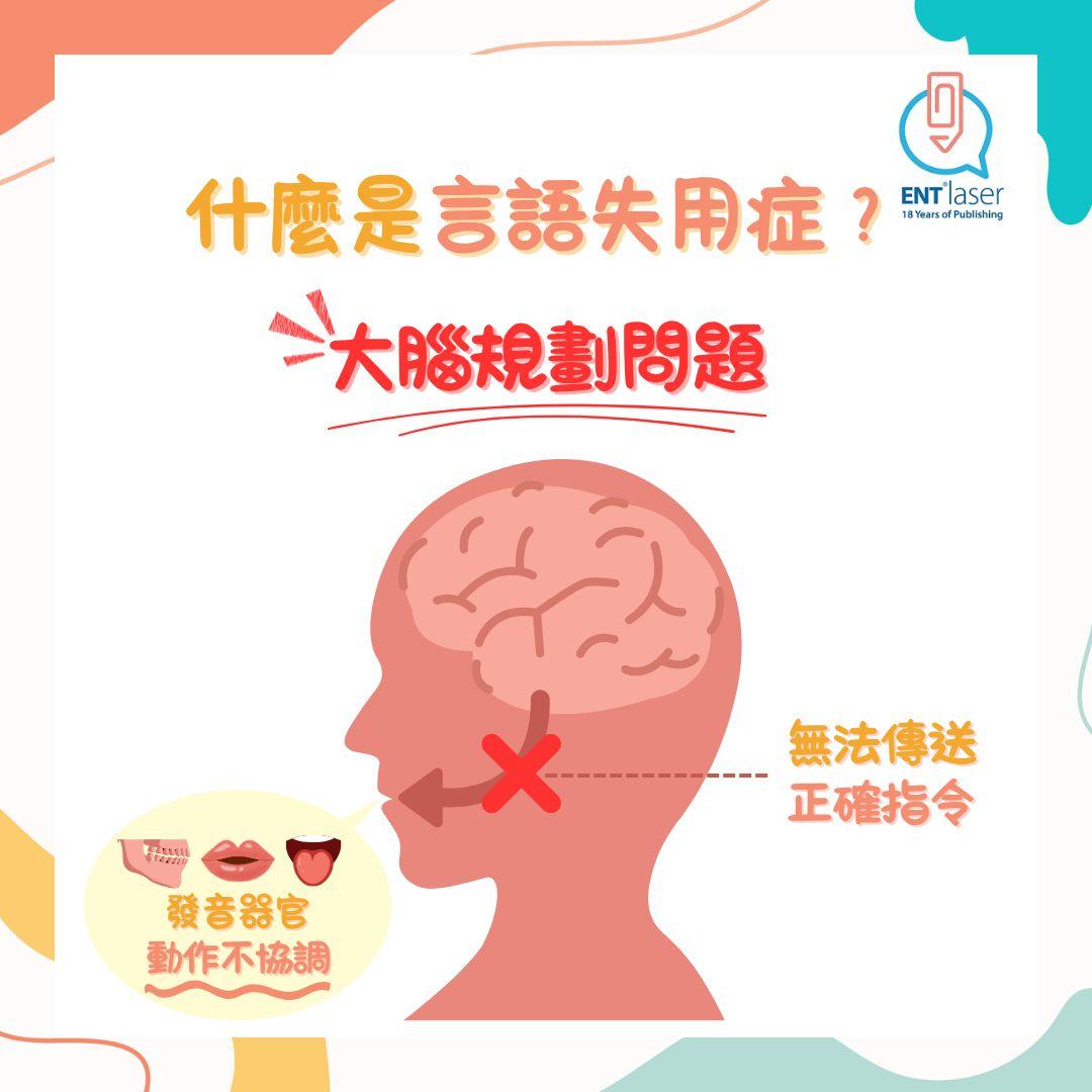 言語失用症（Apraxia of Speech, AOS）