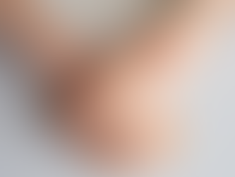 Cisto sinovial recidiva? Entenda por que ele pode voltar após o tratamento