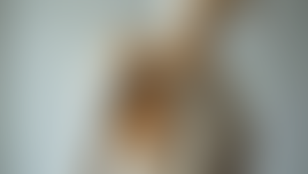 Exploring Stem Cell Therapy for Rotator Cuff Tears: Pros, Cons, and Scientific Insights