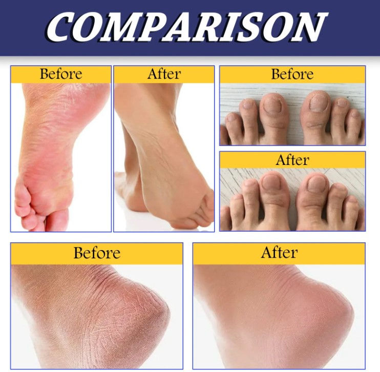 Thumbnail: South Moon - Tea Tree Oil Foot Balm