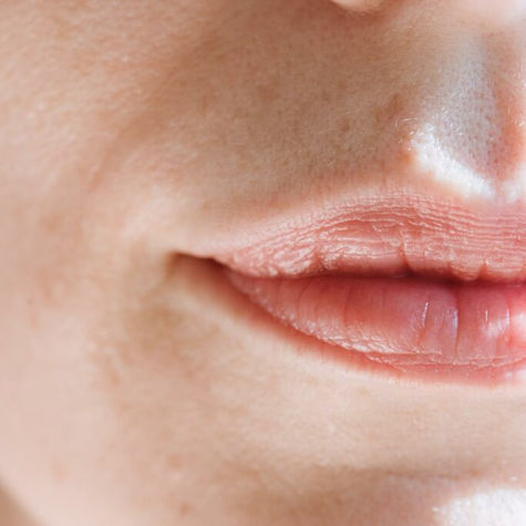 Achieving the Perfect Pout: Lip Filler Dos and Don'ts for 2024