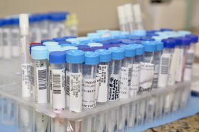 SÃO PAULO REGISTRA TAXAS DE OCUPAÇÃO DE UTIS DE 42,3% NA GRANDE SP E 39,4% NO ESTADO