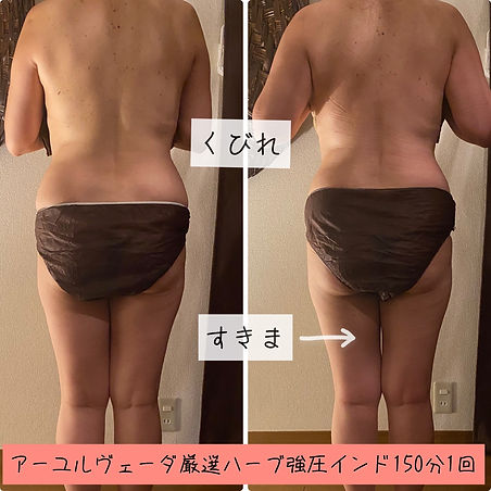 インドエステrise 自由が丘 デトックス痩身 インドエステrise 自由が丘 デトックス痩身