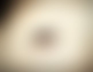 Bug Bites are Beyond Annoying: Try These Home Remedies