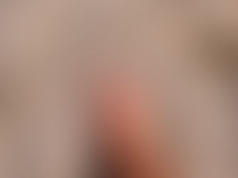 Cracked Feet can Slow You Down This Summer