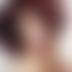 Chapped Lips aren’t Just a Winter Time Problem