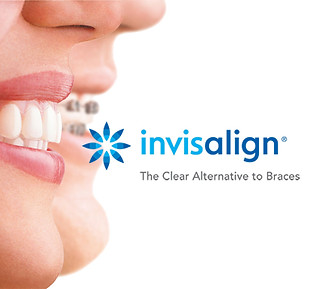 services-invisalign-banner.jpg