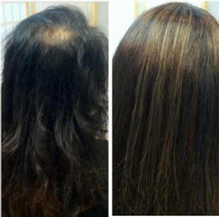 Sleek Style Salon Trichotillomania before and after picture