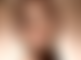 Dra. Mariana Ribeiro: Biosubcision e a nova lógica da estética global