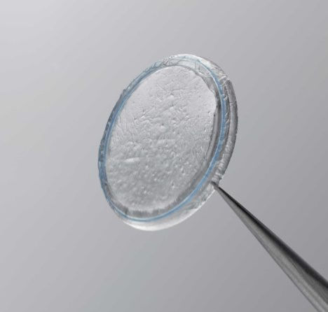 Prokera Amniotic Membrane