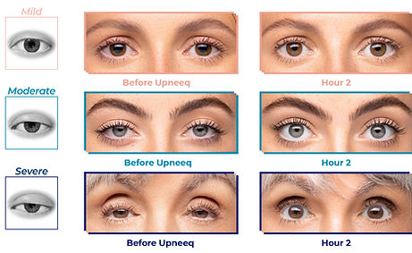 Upneeq droopy images.jpeg