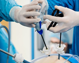 Laparoskopik Ameliyatlar