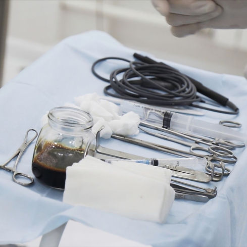 Laparoskopik Ameliyatlar