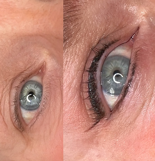 Permanent eyeliner tattoo