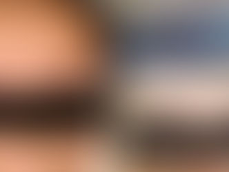 Atenção! Graves erros em Micropigmentação na região.