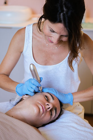 Microneedling ACS PEN Nimes