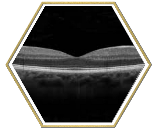 scare-free-eye-exam-winnipeg