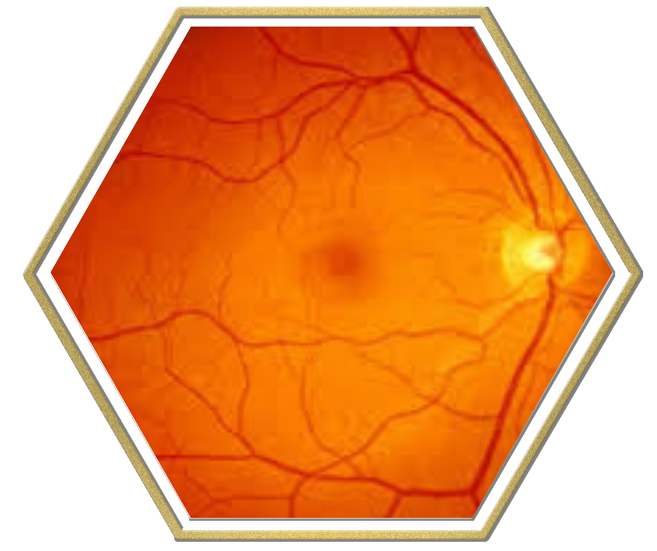 scare-free-eye-exam-winnipeg