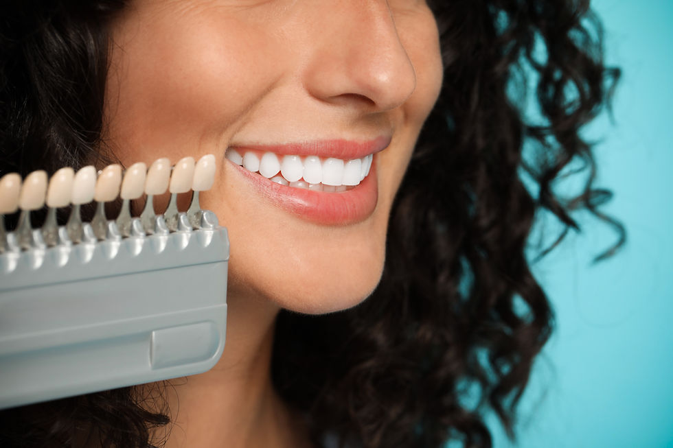 Close-up of a patient's smile beside a dental shade guide tool matching natural enamel for whitening and veneers.