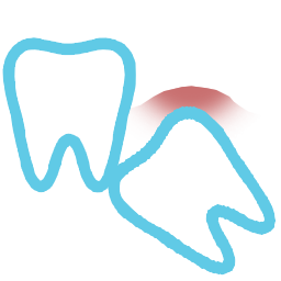 Third molar surgeries