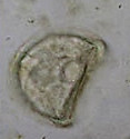 Horse tapeworm egg