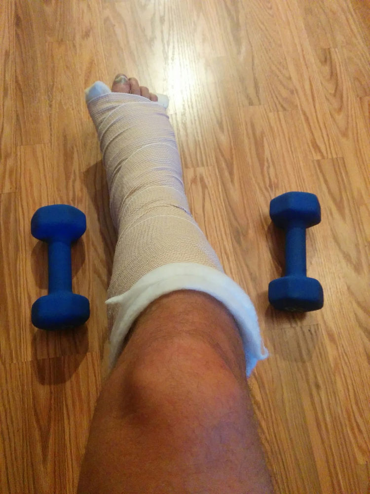 Exercises In A Lower Limb Splint