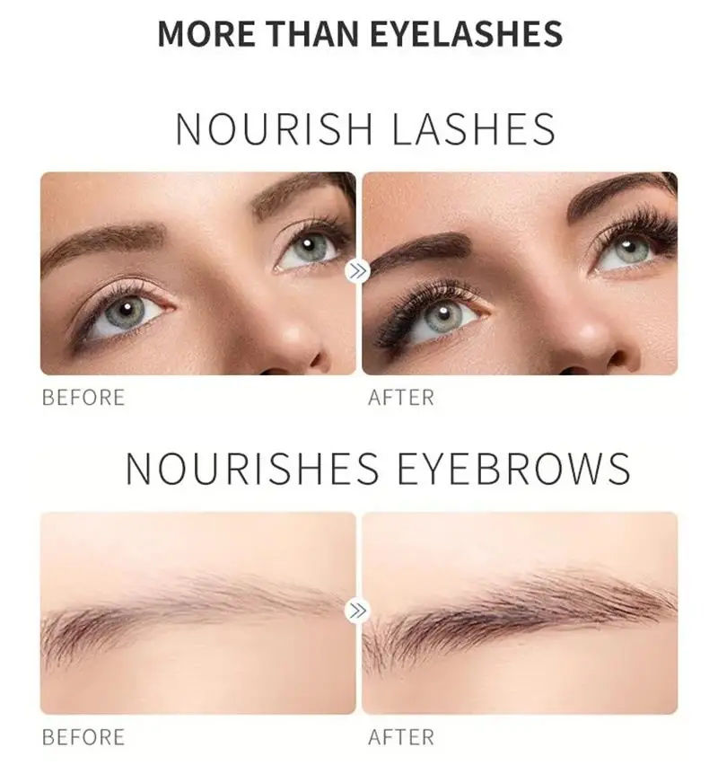 Thumbnail: Nourished eyelashes and eyebrows before and after