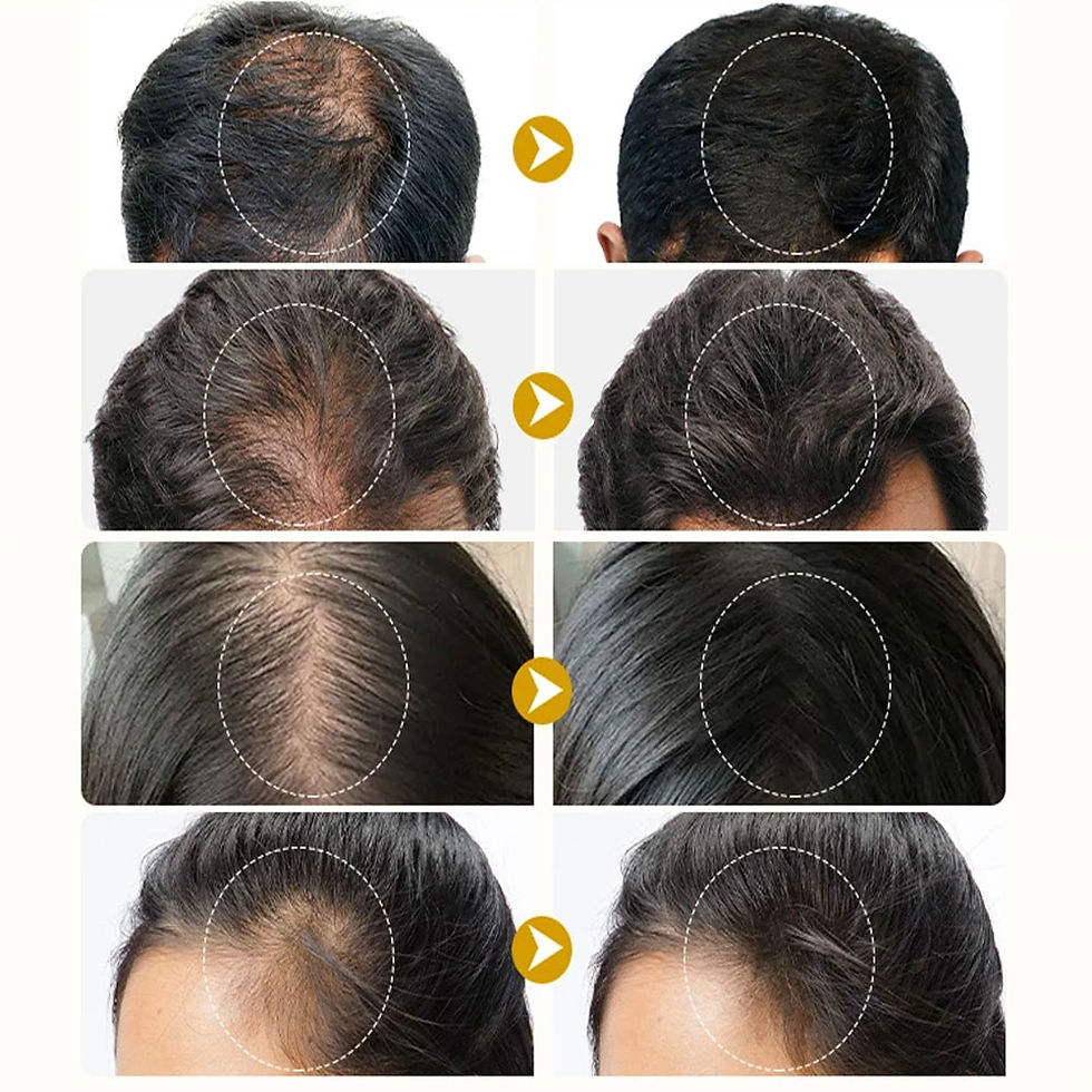 Miniatura: Spray de Crescimento Rápido de Cabelo com Gengibre, Sérum Anti-Queda e Reparador