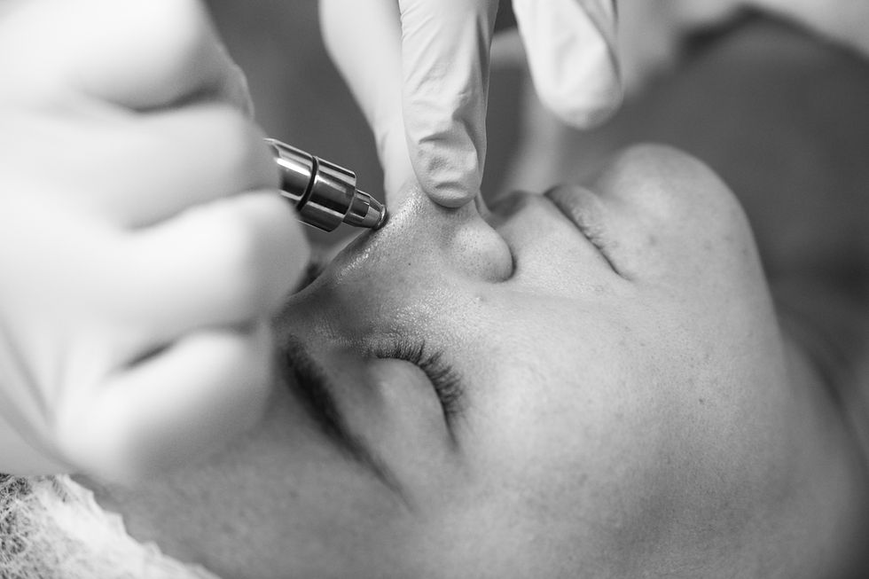 Tratamientos Faciales