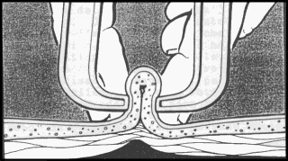 La composizione corporea: plicometria