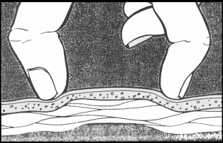 La composizione corporea: plicometria