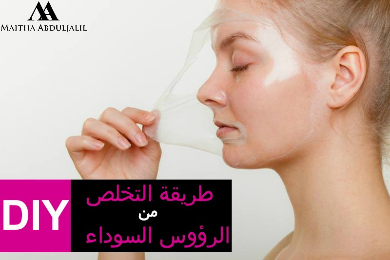 blackheads DIY mask