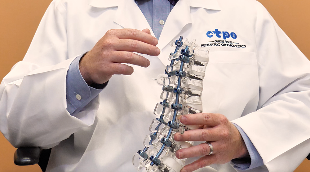 Schroth Method for Treating Scoliosis