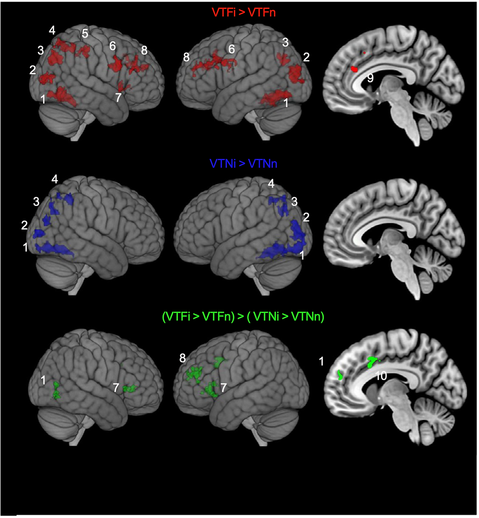 Fig 1. Las regiones cerebrales que se activan tras una amenaza infecciosa percibida.