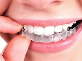 invisalign cambridge.jpg