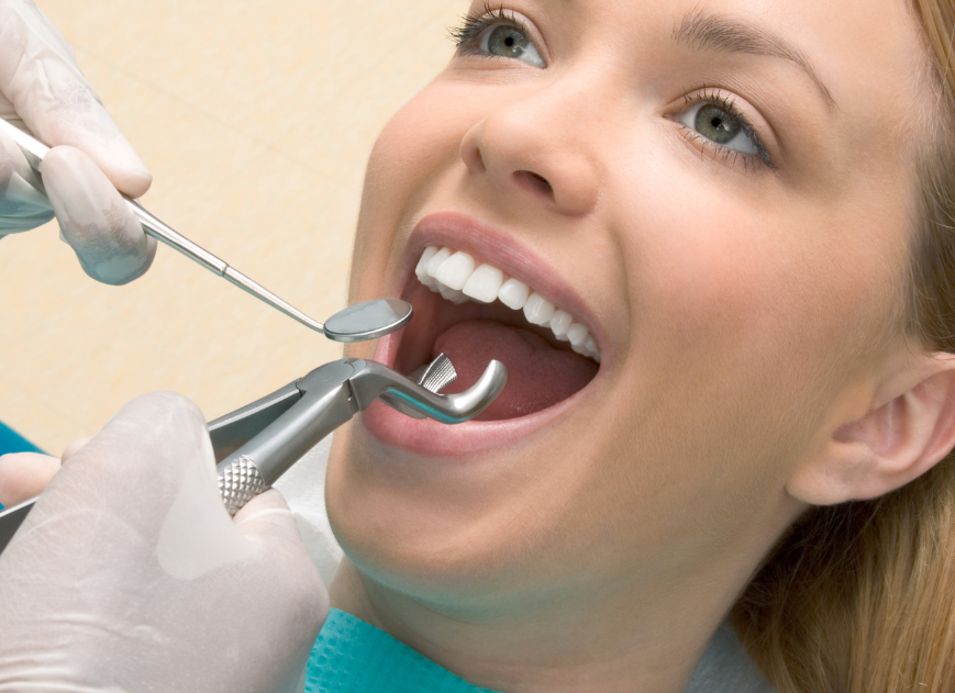 teeth-extraction-dentist-kamloops.png