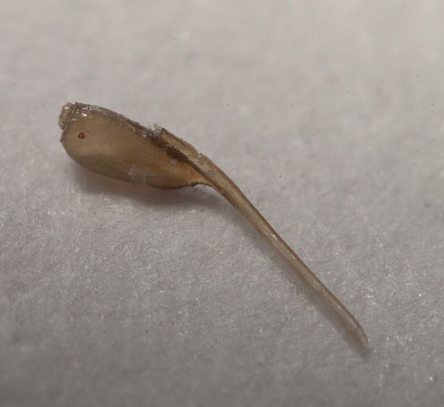 Faq About Head Lice Eggs Nitnot Lice Clinic Herts Uk