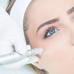 microneedling2.jpeg