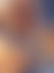 How can I place my fenestrations?