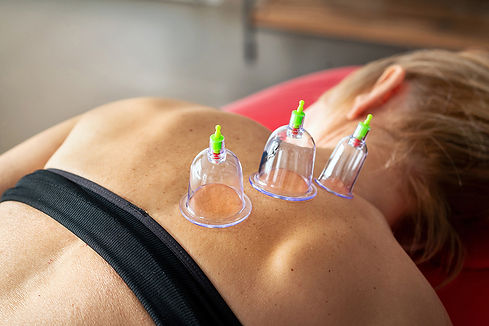 Cupping.jpg