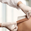 Taping a shoulder wound_edited_edited.png