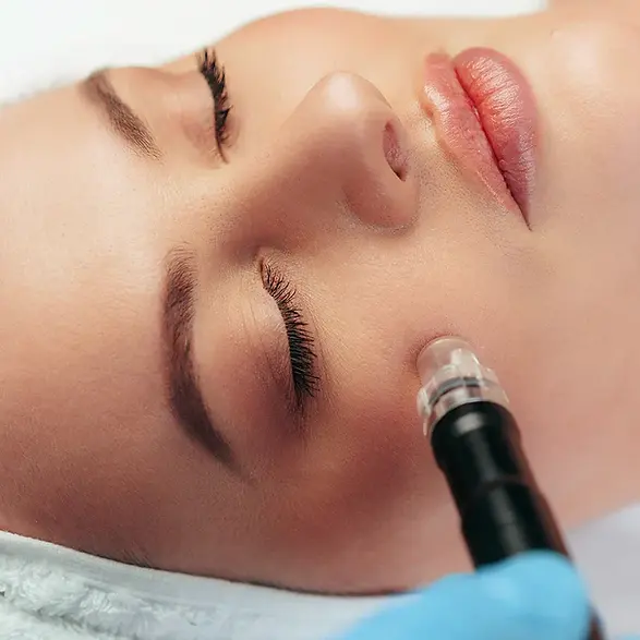 deluxe-spa-hydrapen-mesotherapy_1.webp