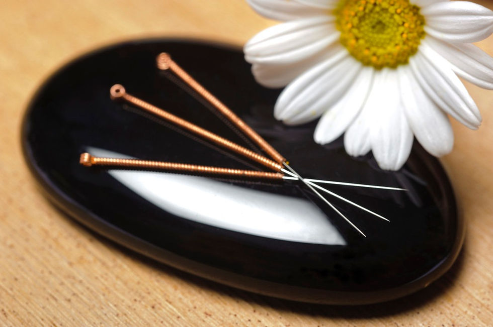 Acupuncture for stress relief 