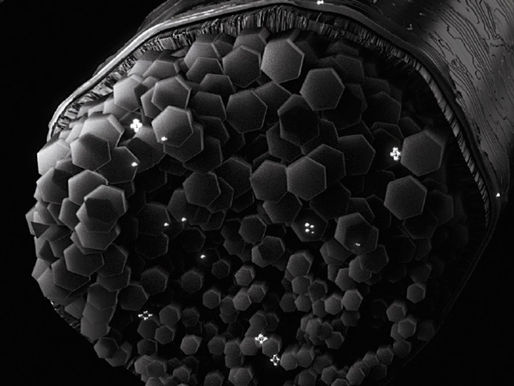 magnified image of hair shaft showing heavy metal deposit