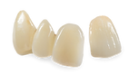 Veneer.png
