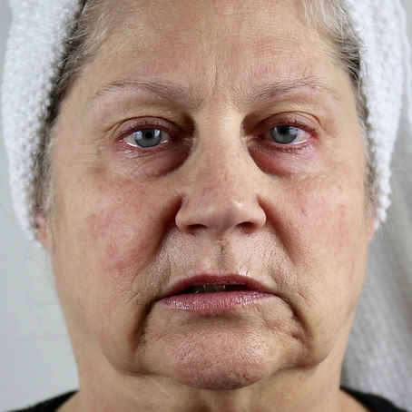 DO THE RESULTS LAST?